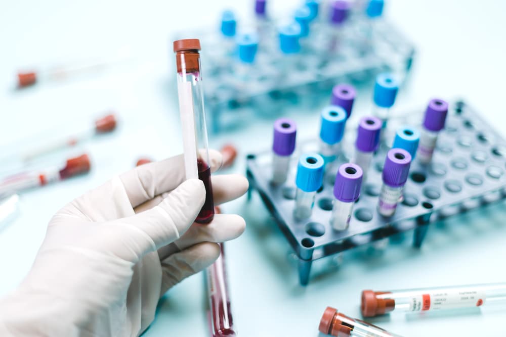 ilustrační foto ilustrační foto