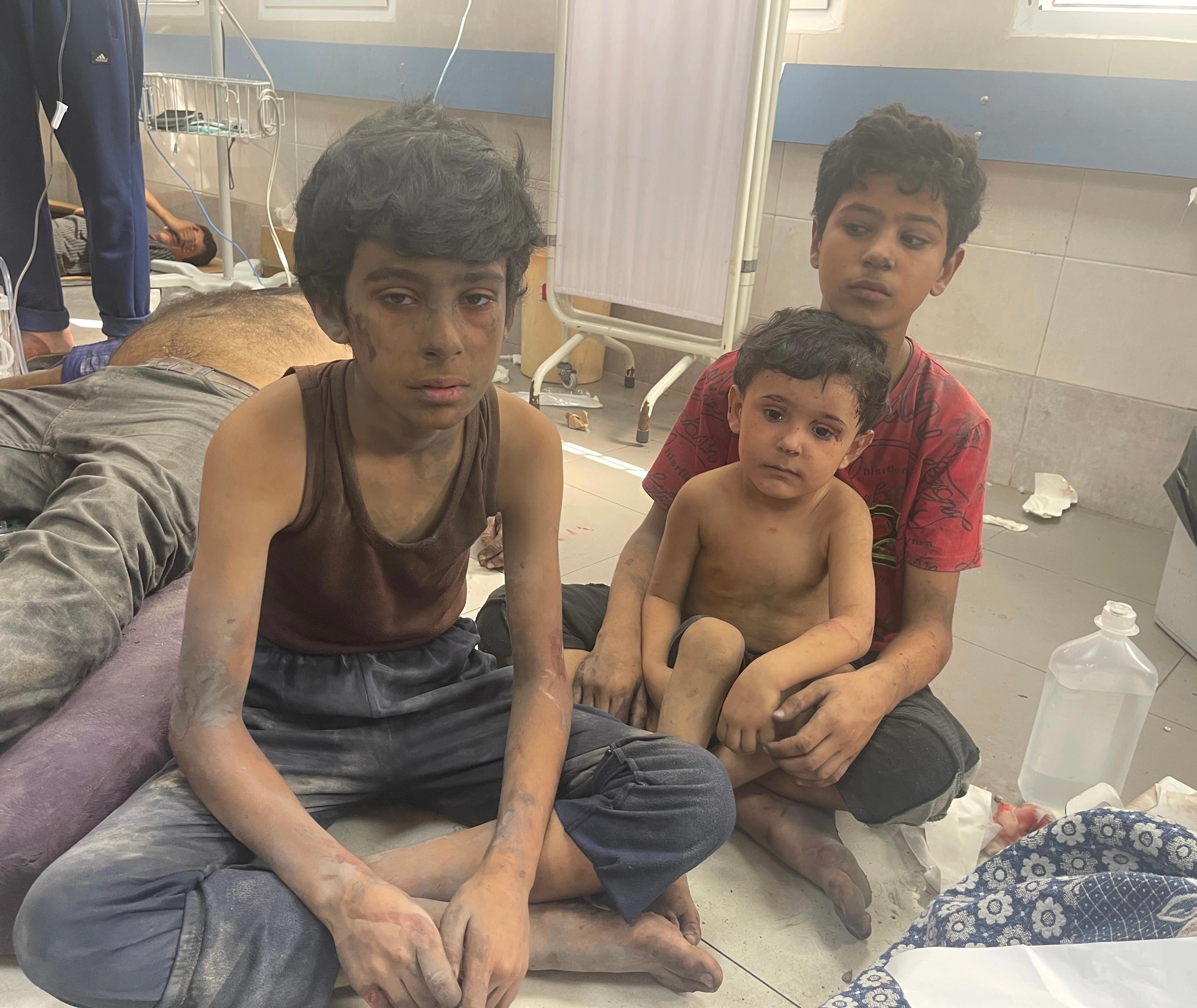 Zraněné palestinské děti v nemocnici v Gaze